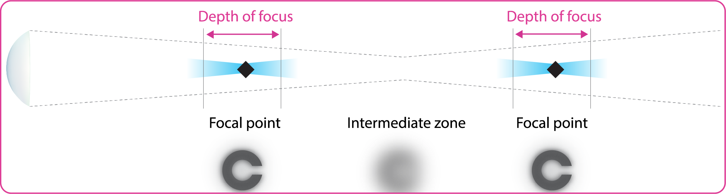 Bifocal-lens-focus-illustration